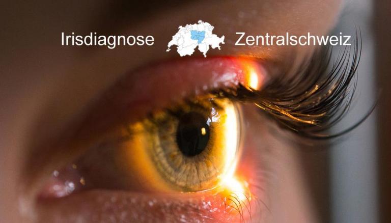 Irisdiagnose Zentralschweiz