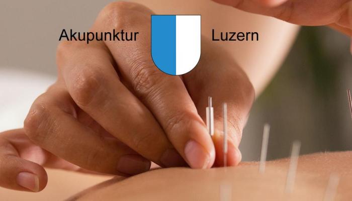 Akupunktur Luzern