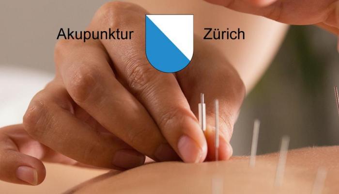 Akupunktur Zürich