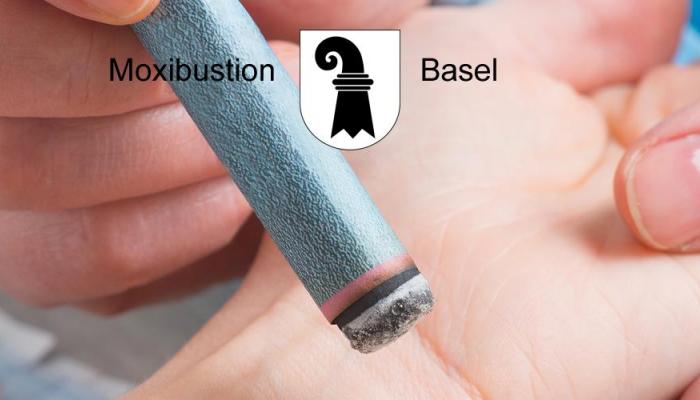 Moxibustion Basel