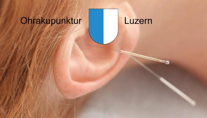 Ohrakupunktur Luzern